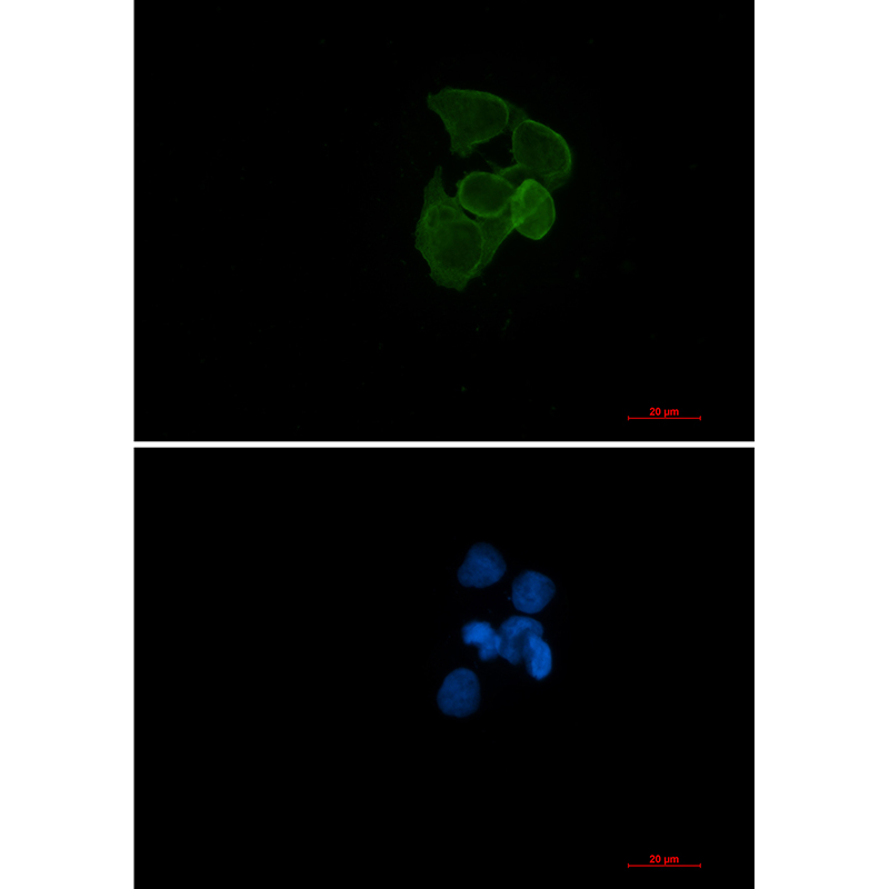 WB - alpha Skeletal Muscle Actin Rabbit mAb AP76605